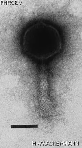 HER241 Image of phage under microscope