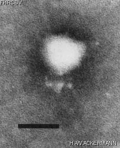 Image of phage under microscope