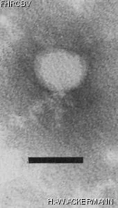 HER244 Image of phage under microscope