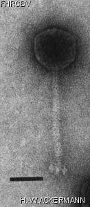 HER245 Image of phage under microscope