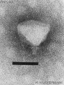 Image of phage under microscope