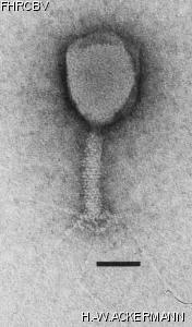 HER25 Image of phage under microscope