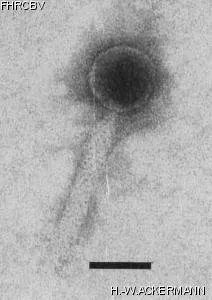 HER251 Image of phage under microscope