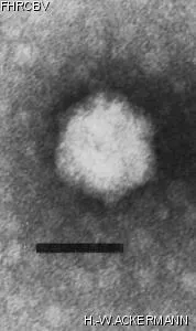 HER254 Image of phage under microscope