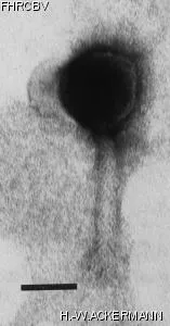 HER255 Image of phage under microscope