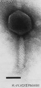 HER259 Image of phage under microscope