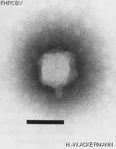 HER26 Image of phage under microscope