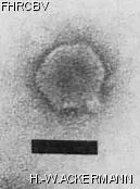 HER264 Image of phage under microscope