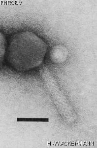 HER266 Image of phage under microscope