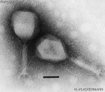 HER27 Image of phage under microscope