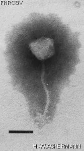 HER273 Image of phage under microscope