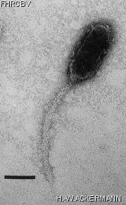 HER275 Image of phage under microscope
