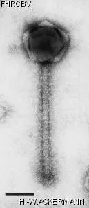 HER276 Image of phage under microscope
