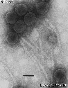 HER278 Image of phage under microscope