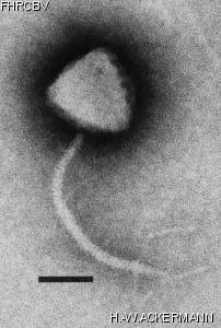 HER28 Image of phage under microscope