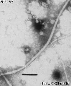 Image of phage under microscope