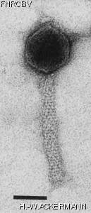 HER282 Image of phage under microscope