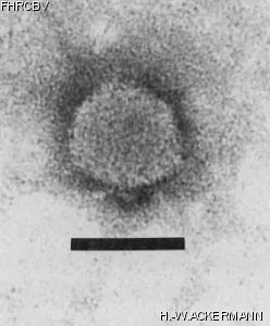 Image of phage under microscope