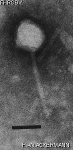 HER285 Image of phage under microscope