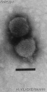 Image of phage under microscope