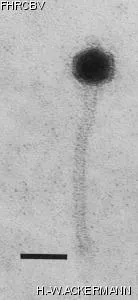 HER288 Image of phage under microscope