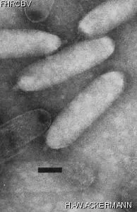 HER289 Image of phage under microscope