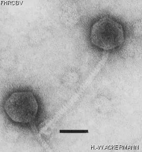 HER292 Image of phage under microscope