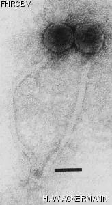 Image of phage under microscope