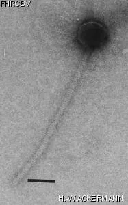 Image of phage under microscope