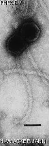 HER298 Image of phage under microscope