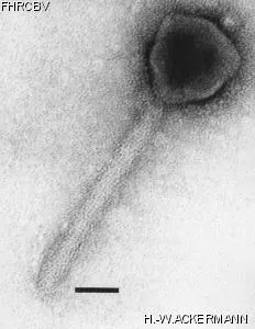 HER300 Image of phage under microscope