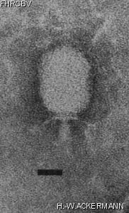 HER303 Image of phage under microscope