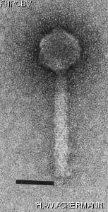 HER31 Image of phage under microscope