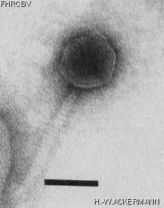 HER311 Image of phage under microscope
