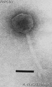 Image of phage under microscope