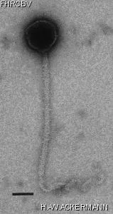 HER314 Image of phage under microscope
