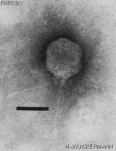 Image of phage under microscope