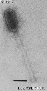 Image of phage under microscope