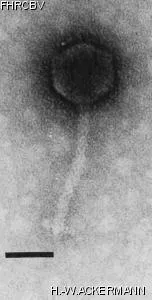 HER318 Image of phage under microscope