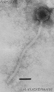 Image of phage under microscope