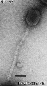 HER32 Image of phage under microscope