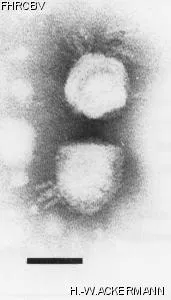Image of phage under microscope