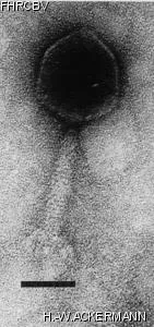 Image of phage under microscope