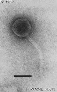 Image of phage under microscope