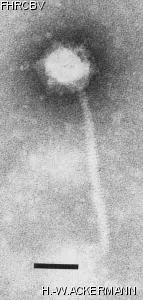 HER327 Image of phage under microscope
