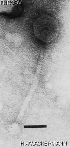 Image of phage under microscope