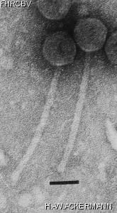 HER334 Image of phage under microscope