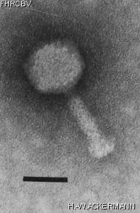 HER336 Image of phage under microscope