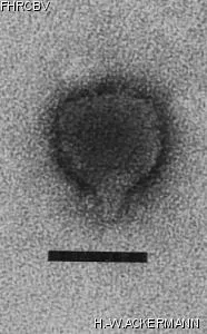 HER337 Image of phage under microscope