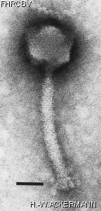 Image of phage under microscope